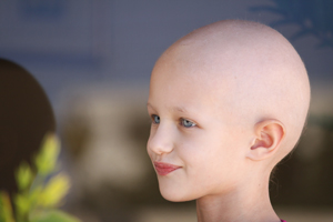Child with no Hair Due to Chemotherapy Treatments